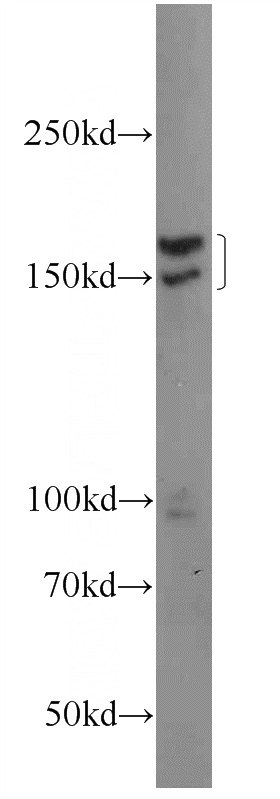 HeLa cells were subjected to SDS PAGE followed by western blot with Catalog No:111804(INO80 Antibody) at dilution of 1:600