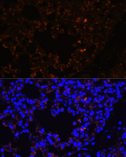 Immunofluorescence - TLR2 Polyclonal Antibody 