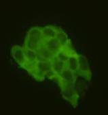 Fig3: ICC image of CD79a antibody stained NCCIT cells. The secondary antibody (green) was goat anti-rabbit IgG (H+L) FITC conjugated.