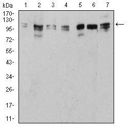 Fig3: Western blot analysis of ULK2 on different cell lysate using anti-ULK2 antibody at 1/1,000 dilution.; Positive control:; Lane 1: NIH/3T3; Lane 2: HepG2; Lane 3: SK-Hep-1; Lane 4: SK-OV-3; Lane 5: C6; Lane 6: PC-12; Lane 7: MCF-7