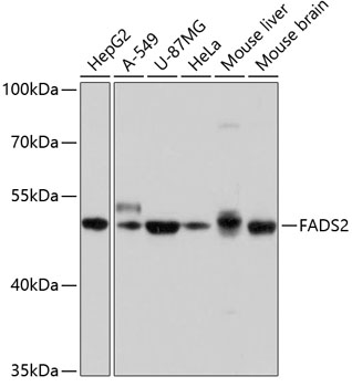 Western blot - FADS2 Polyclonal Antibody 