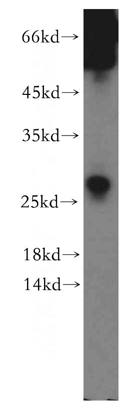 human testis tissue were subjected to SDS PAGE followed by western blot with Catalog No:115620(SSX5 antibody) at dilution of 1:300