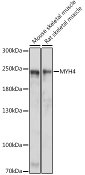 Western blot - MYH4 Polyclonal Antibody 