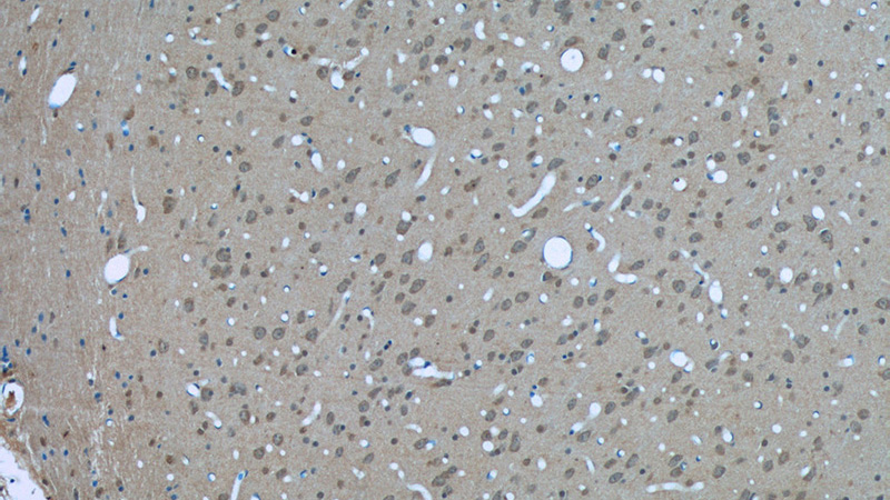 Immunohistochemistry of paraffin-embedded rat brain tissue slide using Catalog No:107550(14-3-3 Antibody) at dilution of 1:50 (under 10x lens)