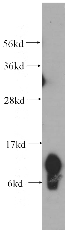 human liver tissue were subjected to SDS PAGE followed by western blot with Catalog No:116639(UQCRQ antibody) at dilution of 1:500