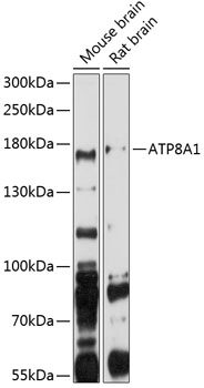 Western blot - ATP8A1 Polyclonal Antibody 