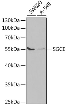 Western blot - SGCE Polyclonal Antibody 