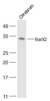 Fig3: Sample:; Cerebrum (Mouse) Lysate at 40 ug; Primary: Anti-BarX2 at 1/500 dilution; Secondary: IRDye800CW Goat Anti-Rabbit IgG at 1/20000 dilution; Predicted band size: 31 kD; Observed band size: 31 kD