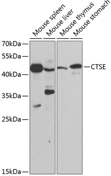 Western blot - CTSE Polyclonal Antibody 