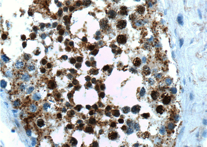 Immunohistochemistry of paraffin-embedded human testis tissue slide using Catalog No:108756(CABYR Antibody) at dilution of 1:200 (under 40x lens)