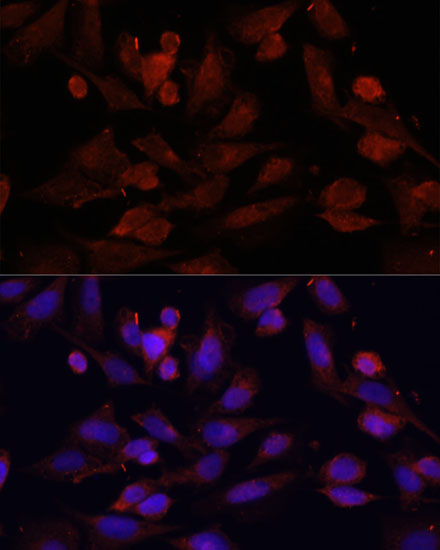 Immunofluorescence - GPER1 Polyclonal Antibody 