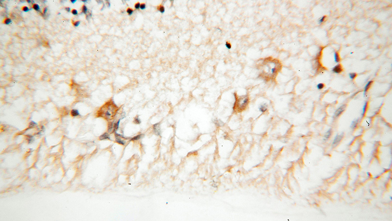 Immunohistochemical of paraffin-embedded human eye using Catalog No:111979(KCNS2 antibody) at dilution of 1:100 (under 40x lens)