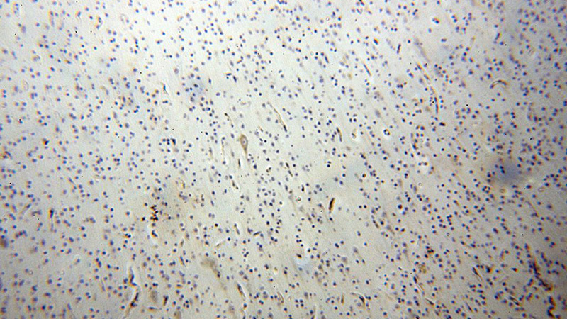 Immunohistochemical of paraffin-embedded human brain using Catalog No:115659(SQRDL antibody) at dilution of 1:100 (under 10x lens)