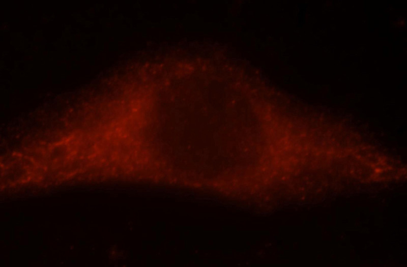 Immunofluorescent analysis of Hela cells, using NBR1 antibody Catalog No:113023 at 1:25 dilution and Rhodamine-labeled goat anti-rabbit IgG (red).