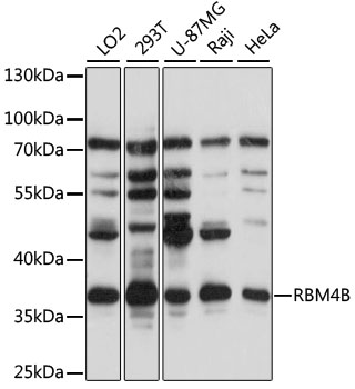 Western blot - RBM4B Polyclonal Antibody 