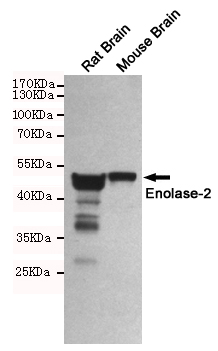 Western blot detection of Enolase-2 in Rat Brain and Mouse Brain lysates using Enolase-2 mouse mAb (1:1000 diluted).Predicted band size:47KDa.Observed band size:47KDa.