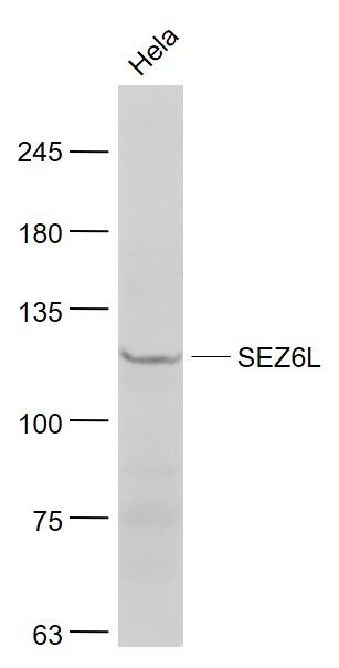 Fig2: Sample:; Hela(Human) Cell Lysate at 30 ug; Primary: Anti- SEZ6L at 1/1000 dilution; Secondary: IRDye800CW Goat Anti-Rabbit IgG at 1/20000 dilution; Predicted band size: 109 kD; Observed band size: 110 kD