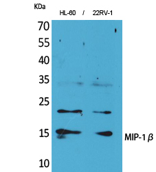 Fig1:; Western Blot analysis of HL-60, 22RV-1 cells using MIP-1β Polyclonal Antibody.. Secondary antibody（catalog#：HA1001) was diluted at 1:20000