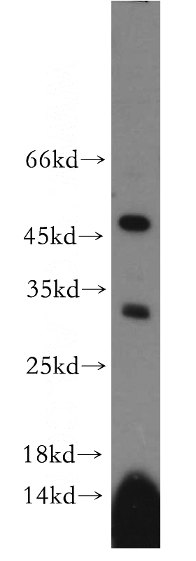 PC-3 cells were subjected to SDS PAGE followed by western blot with Catalog No:114671(RDM1 antibody) at dilution of 1:500