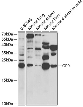Western blot - GP9 Polyclonal Antibody 