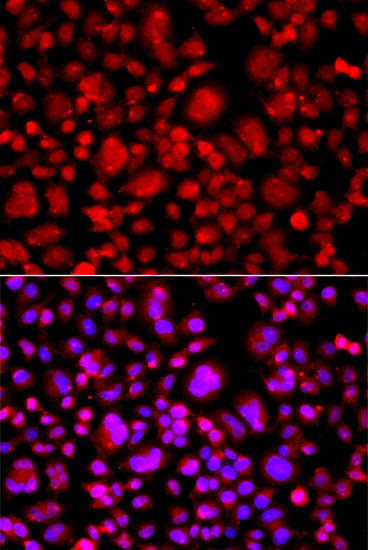 Immunofluorescence - TP53BP2 Polyclonal Antibody 