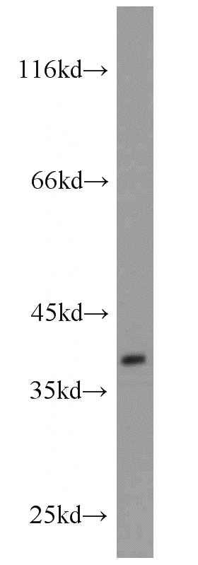 MCF7 cells were subjected to SDS PAGE followed by western blot with Catalog No:111011(GNRHR antibody) at dilution of 1:500