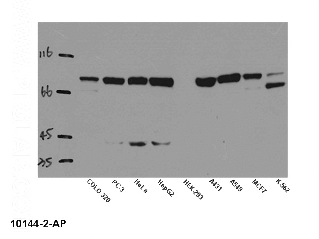 WB result of anti-STAT1 (Catalog No:115684) in different cells lysates