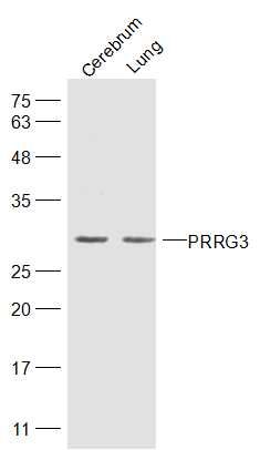 Fig1: Sample:; Cerebrum (Mouse) Lysate at 40 ug; Lung (Mouse) Lysate at 40 ug; Primary: Anti-PRRG3 at 1/300 dilution; Secondary: IRDye800CW Goat Anti-Rabbit IgG at 1/20000 dilution; Predicted band size: 24 kD; Observed band size: 28 kD