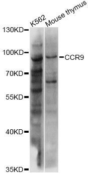 Western blot - CCR9 Polyclonal Antibody 