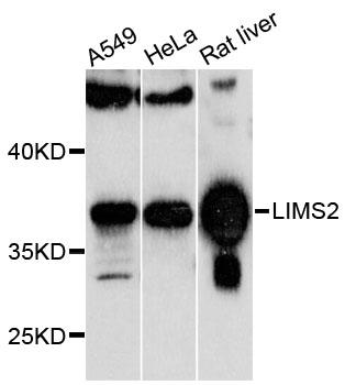 Western blot - LIMS2 Polyclonal Antibody 