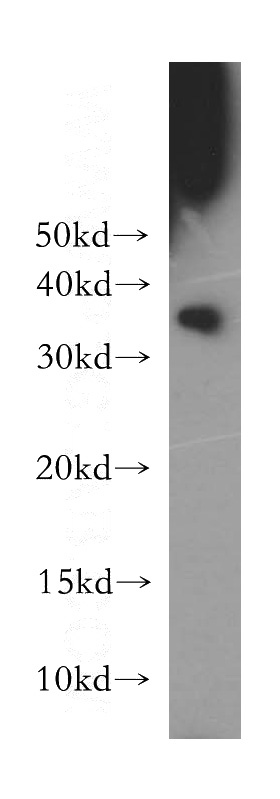 HeLa cells were subjected to SDS PAGE followed by western blot with Catalog No:109155(CDK1 antibody) at dilution of 1:300