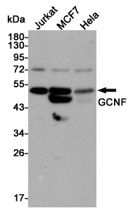 Western blot detection of GCNF in Jurkat,MCF7 and Hela cell lysates using GCNF mouse mAb (1:3000 diluted).Predicted band size:54KDa.Observed band size:54KDa.