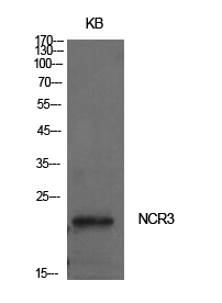Fig1:; Western Blot analysis of KB cells using NKp30 Polyclonal Antibody.. Secondary antibody（catalog#：HA1001) was diluted at 1:20000