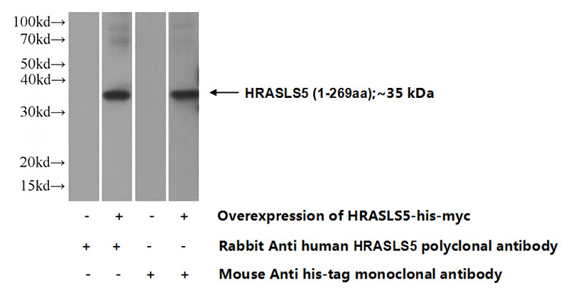 Transfected HEK-293 cells were subjected to SDS PAGE followed by western blot with Catalog No:111459(HRASLS5 Antibody) at dilution of 1:1000