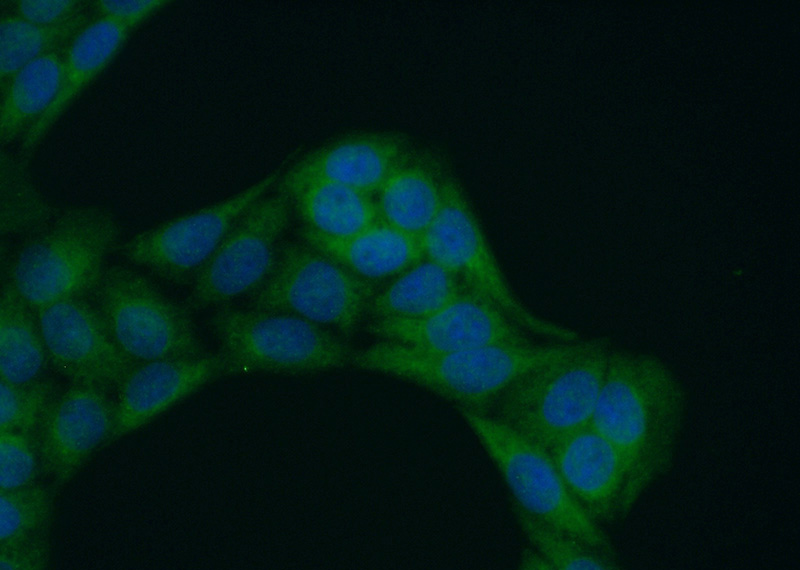 Immunofluorescent analysis of (-20oc Ethanol) fixed HeLa cells using Catalog No:112158(LAX1 Antibody) at dilution of 1:50 and Alexa Fluor 488-congugated AffiniPure Goat Anti-Rabbit IgG(H+L)