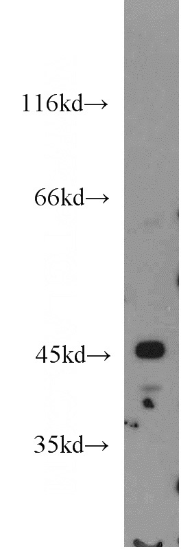 HeLa cells were subjected to SDS PAGE followed by western blot with Catalog No:115717(STK32A antibody) at dilution of 1:800