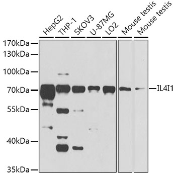 Western blot - IL4I1 Polyclonal Antibody 