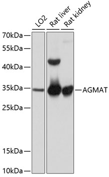 Western blot - AGMAT Polyclonal Antibody 