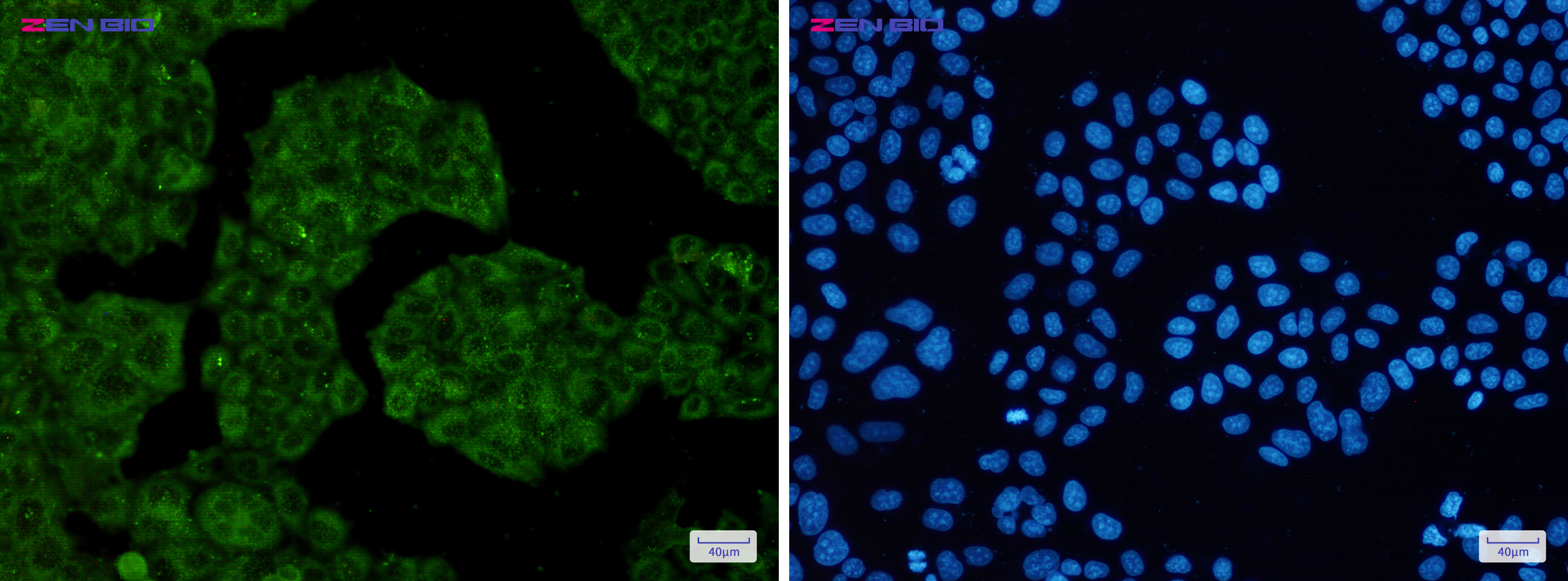 Immunocytochemistry of NUDT9(green) in Hela cells using NUDT9 Rabbit pAb at dilution 1/50, and DAPI(blue)