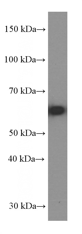 fetal human brain tissue were subjected to SDS PAGE followed by western blot with Catalog No:107299(GLS Antibody) at dilution of 1:10000