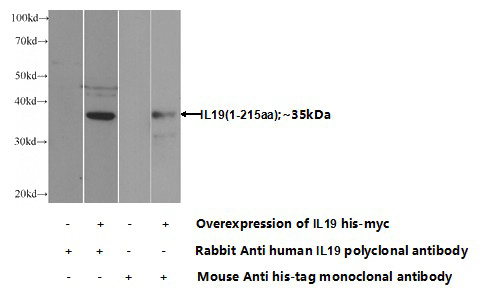 Transfected HEK-293 cells were subjected to SDS PAGE followed by western blot with Catalog No:111769(IL19 Antibody) at dilution of 1:1000