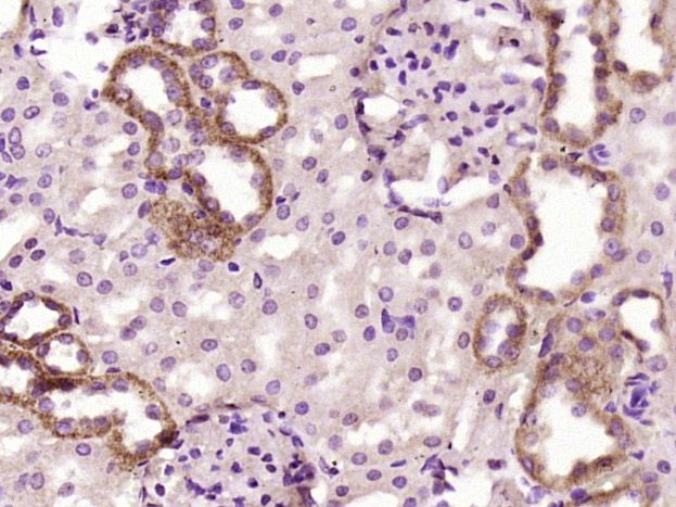 Fig3: Paraformaldehyde-fixed, paraffin embedded (rat kidney tissue); Antigen retrieval by boiling in sodium citrate buffer (pH6.0) for 15min; Block endogenous peroxidase by 3% hydrogen peroxide for 20 minutes; Blocking buffer (normal goat serum) at 37℃ for 30min; Antibody incubation with (C1orf172) Polyclonal Antibody, Unconjugated at 1:400 overnight at 4℃, followed by operating according to SP Kit(Rabbit) (sp-0023) instructionsand DAB staining.