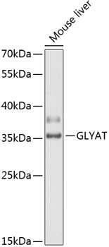 Western blot - GLYAT Polyclonal Antibody 