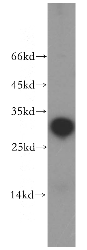 human heart tissue were subjected to SDS PAGE followed by western blot with Catalog No:113279(NRIP2 antibody) at dilution of 1:800