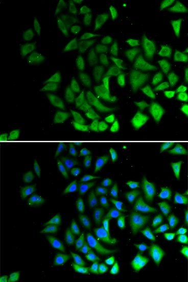 Immunofluorescence - PIWIL1 Polyclonal Antibody 
