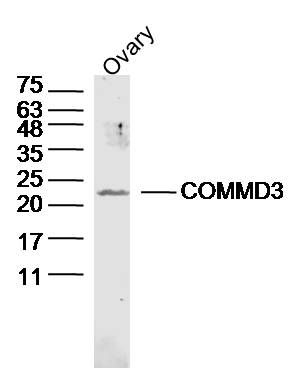 Fig1: Sample: Ovary (Mouse) Lysate at 40 ug; Primary: Anti-COMMD3 at 1/300 dilution; Secondary: IRDye800CW Goat Anti-Rabbit IgG at 1/20000 dilution; Predicted band size: 22 kD; Observed band size: 22 kD