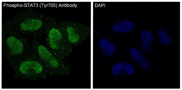Immunofluorescent analysis of HeLa cells treated with IFN-alpha, using Phospho-STAT3 (Y705) Antibody.