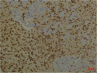 Immunohistochemical analysis of paraffin-embedded Mouse BrainTissue using PI3 Kinase P85 α Mouse mAb diluted at 1:200.