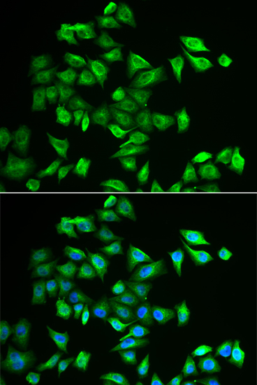 Immunofluorescence - POMGNT2 Polyclonal Antibody 