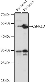 Western blot - CSNK1D Polyclonal Antibody 